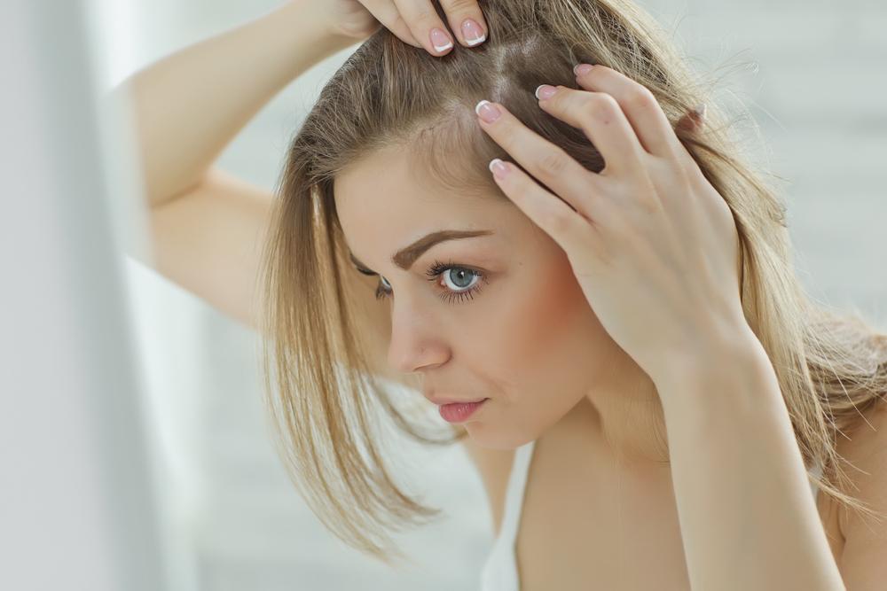 Does Wellbutrin cause hair loss?